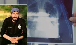 Kanîreş de nêweşîya silîkozîsî ra mergo 32!