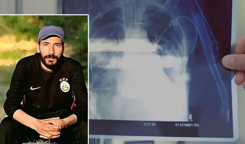 Kanîreş de nêweşîya silîkozîsî ra mergo 32!